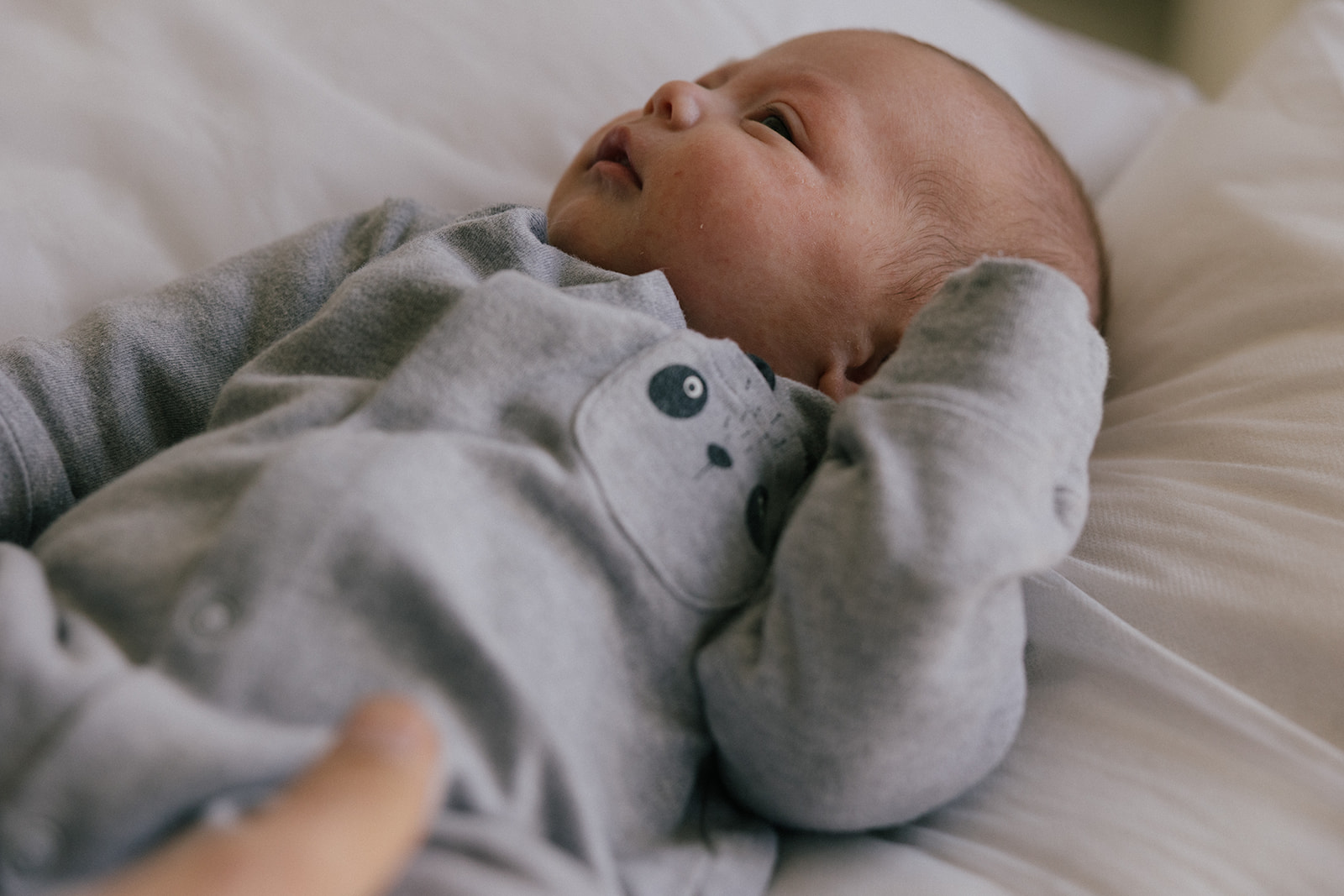 טורטיקוליס