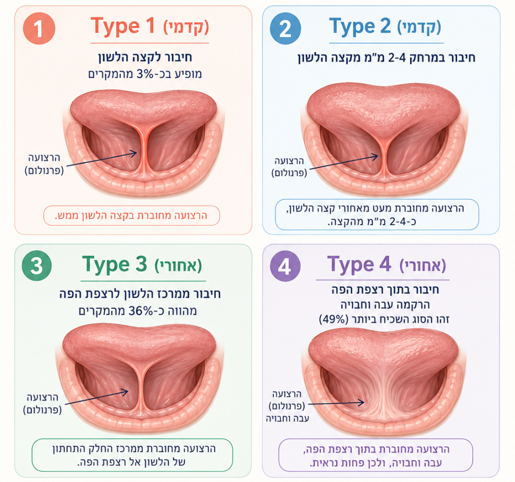 סוגים של לשון קשורה